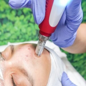 Tratamiento para manchas + limpieza facial de regalo